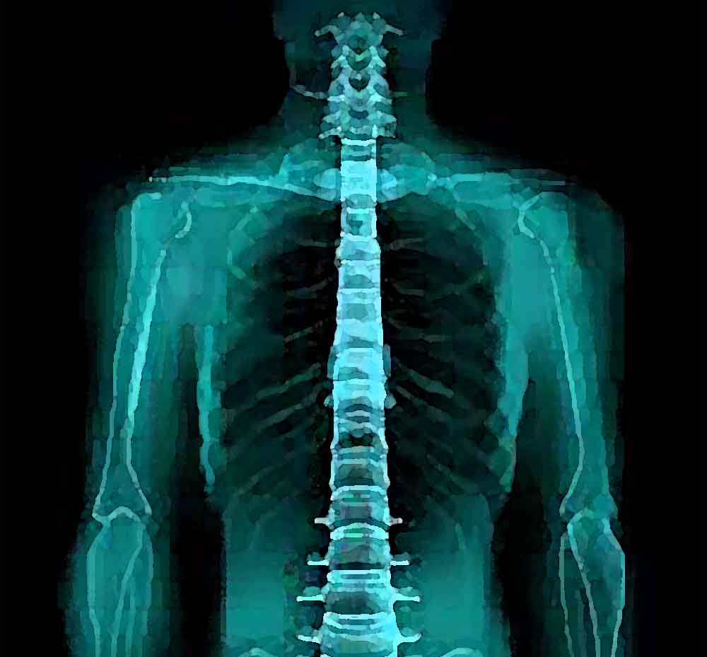 Raios X e a ciência