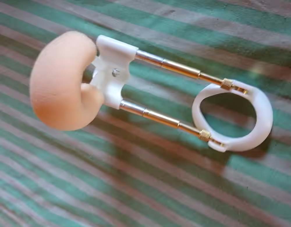 Solução para a doença de peyronie